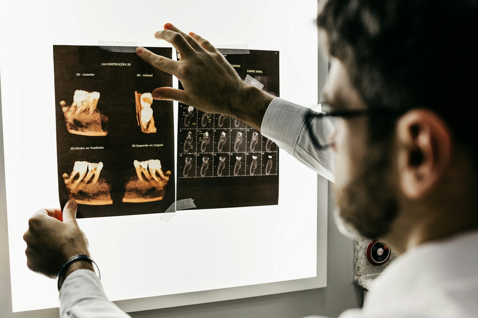 Clinician reviewing dental radiographs